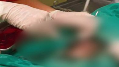 Government doctors sterilize pregnant woman, condition critical after operation