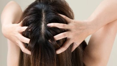 5 ways to prevent stains from accumulating on your scalp