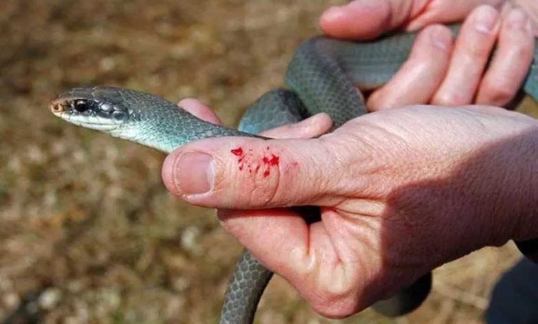 UP: Deaths are happening due to snake bites, state government will give compensation